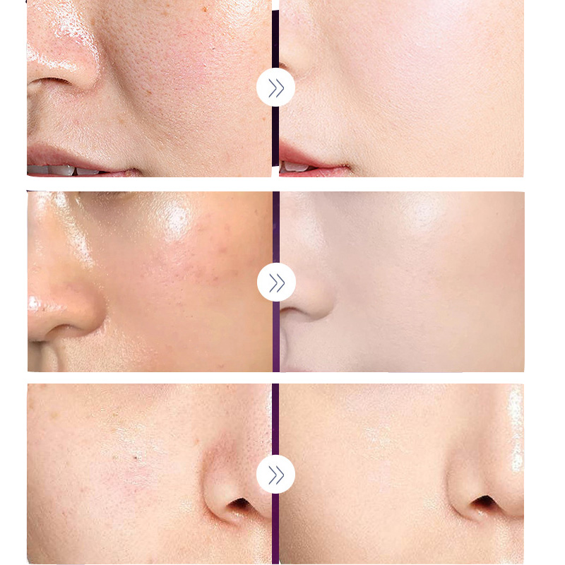 Роскошный благородный фотограф – обзор и цена Skincare Luxury Whitening
