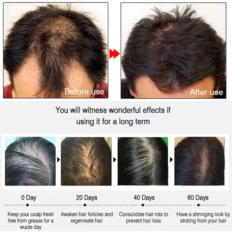 Спрей для быстрого роста волос – обзор и цена Epidermal Growth Factor